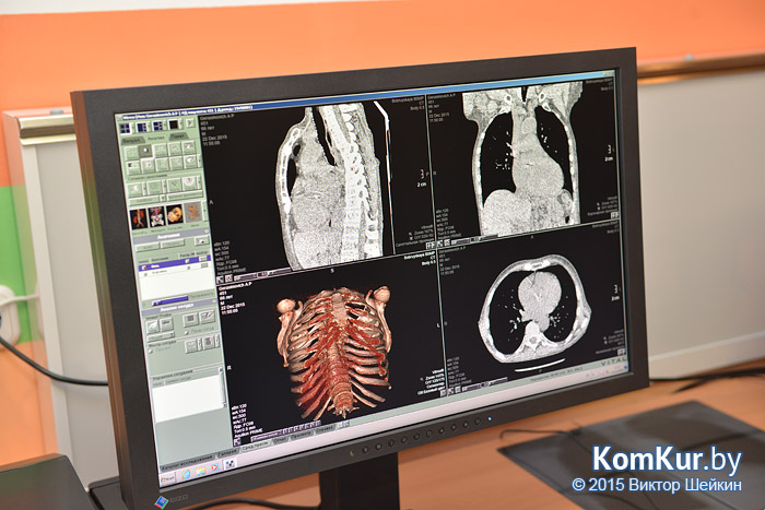 В Бобруйской больнице имени Морзона заработал новый компьютерный томограф 